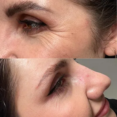 Natalia Borowicz Medycyna Estetyczna